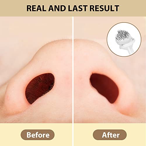 Bouvetan Nose Wax Kit for Men and Women – 100g Nose Hair Wax Beads, 20 Applicators, 15 Mustache Protectors, 10 Paper Cups, 1 Measuring Cup – Easy, Quick, and Instant Nose Hair Removal - görsel 6