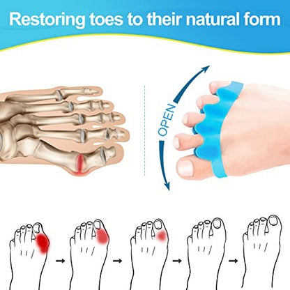 Juzure 8 PCS Professional Silicone Toe Separators for Bunions & Toe Straightening - Correct, Stretch & Realign Toes Naturally