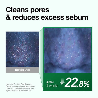 Anua Heartleaf Pore Control Cleansing Oil – Gentle Makeup Remover & Pore Cleanser for All Skin Types, Korean Skincare (6.76 fl oz) Avelisse