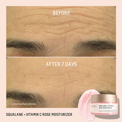 Biossance Squalane + Vitamin C Rose Face Moisturizer – Antioxidant-Rich Hydrating Lotion for Radiant Skin, 1.69 oz Avelisse
