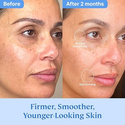 HYDRONOVA Total Rewind Sculpting Serum 1 fl oz – Line-Smoothing Dark Spot Corrector with Vitamin C, Niacinamide, Kojic Acid & Peptides for Radiant Glow Avelisse