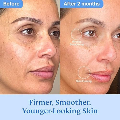 HYDRONOVA Total Rewind Sculpting Serum 1 fl oz – Line-Smoothing Dark Spot Corrector with Vitamin C, Niacinamide, Kojic Acid & Peptides for Radiant Glow Avelisse