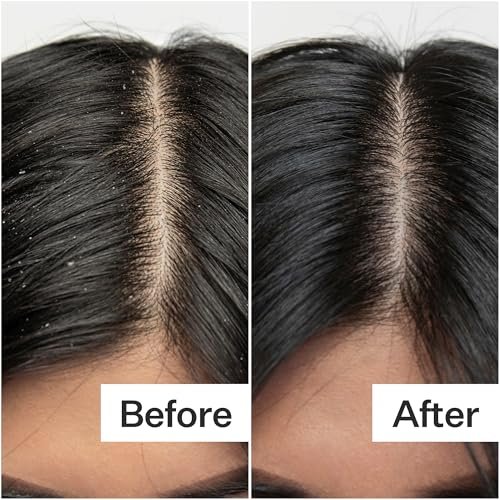 Act+ Acre Cold Processed Salicylic Acid Scalp Exfoliator – 2 Fl Oz Avelisse