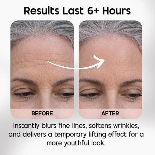 Celestolite Estrella Anti-Wrinkle Syringe - Advanced Skin Smoothing Device Avelisse