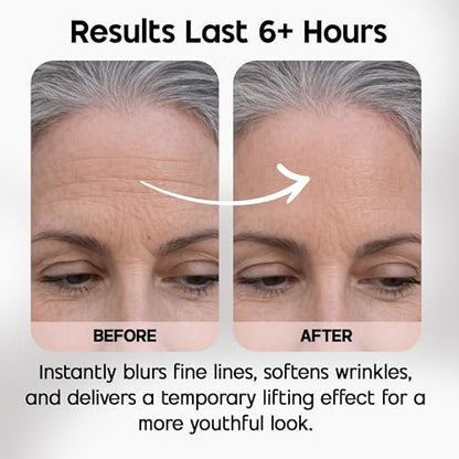Celestolite Estrella Anti-Wrinkle Syringe - Advanced Skin Smoothing Device Avelisse