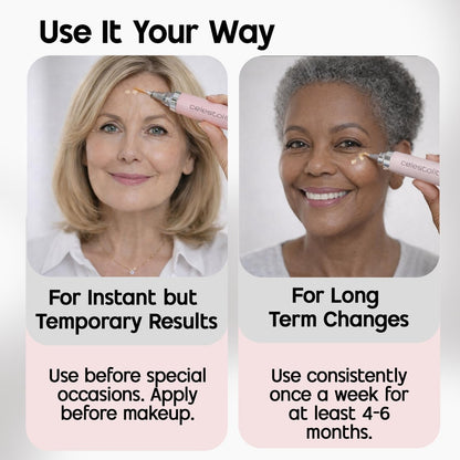 Celestolite Estrella Anti-Wrinkle Syringe - Advanced Skin Smoothing Device Avelisse