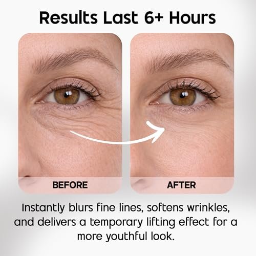 Celestolite Estrella Anti-Wrinkle Syringe - Advanced Skin Smoothing Device Avelisse