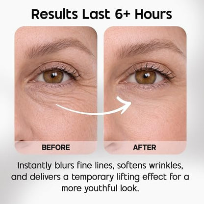 Celestolite Estrella Anti-Wrinkle Syringe - Advanced Skin Smoothing Device Avelisse