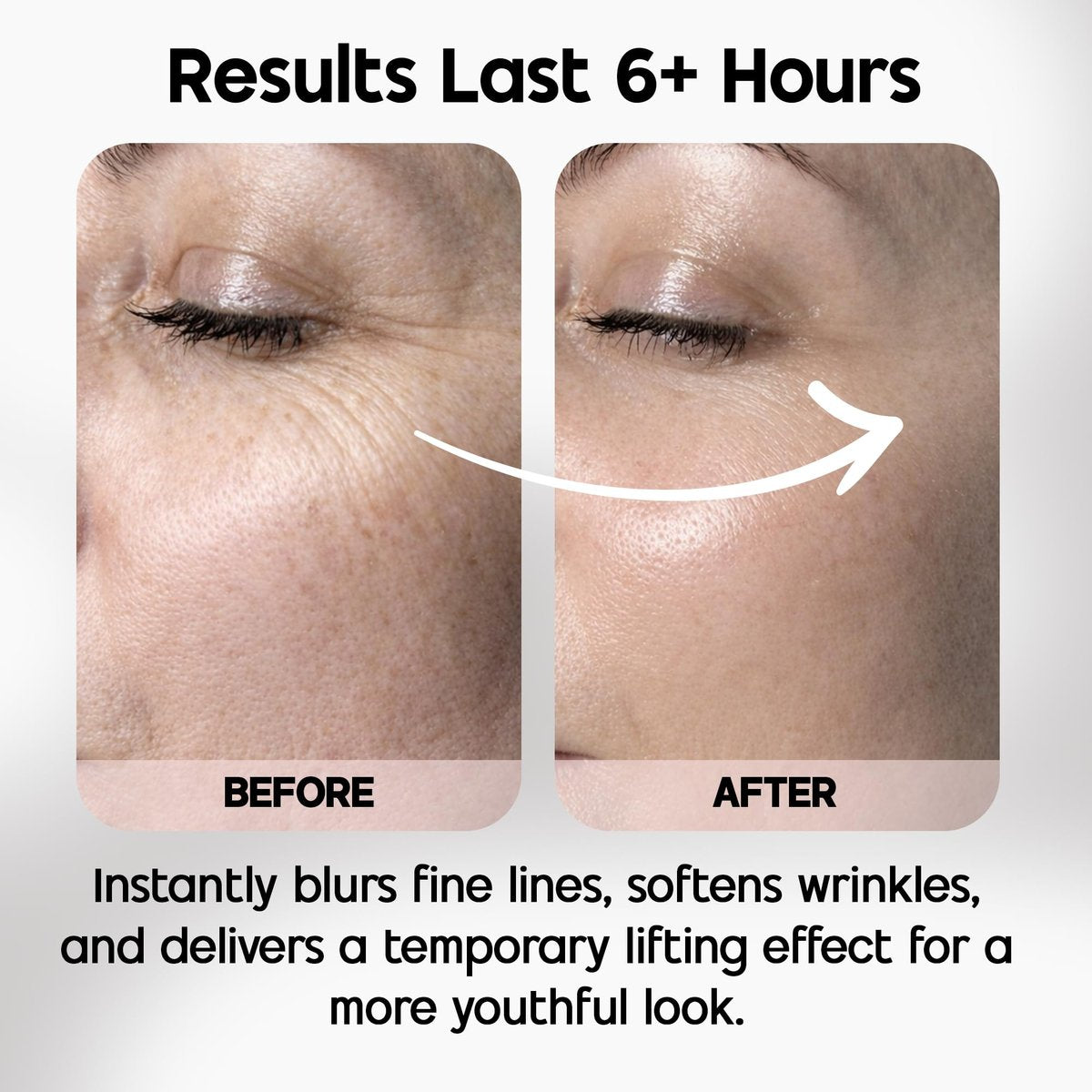 Celestolite Estrella Anti-Wrinkle Syringe - Advanced Skin Smoothing Device Avelisse