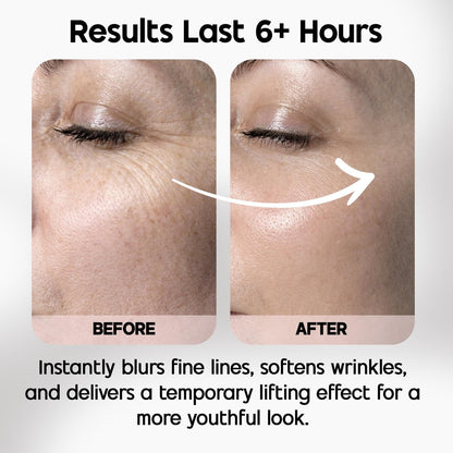 Celestolite Estrella Anti-Wrinkle Syringe - Advanced Skin Smoothing Device Avelisse