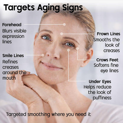 Celestolite Estrella Anti-Wrinkle Syringe - Advanced Skin Smoothing Device Avelisse