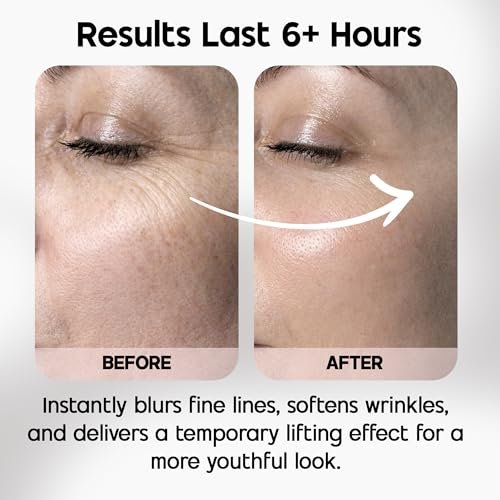 Celestolite Estrella Anti-Wrinkle Syringe - Advanced Skin Smoothing Device Avelisse