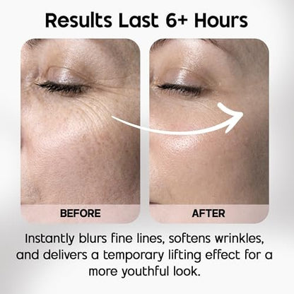Celestolite Estrella Anti-Wrinkle Syringe - Advanced Skin Smoothing Device Avelisse