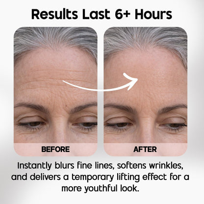Celestolite Estrella Anti-Wrinkle Syringe - Advanced Skin Smoothing Device Avelisse
