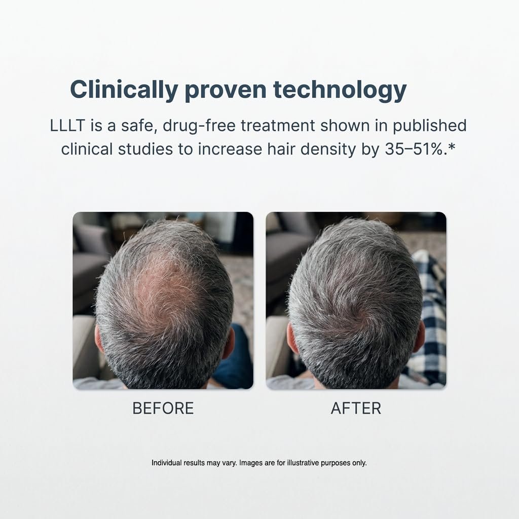 Xtrallux Alpha Hair Growth Laser Cap - FDA Cleared 136 Lasers for Men & Women, SMT Technology, 6-Min Daily Treatment - görsel 5