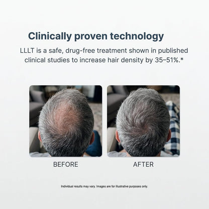 Xtrallux Alpha Hair Growth Laser Cap - FDA Cleared 136 Lasers for Men & Women, SMT Technology, 6-Min Daily Treatment