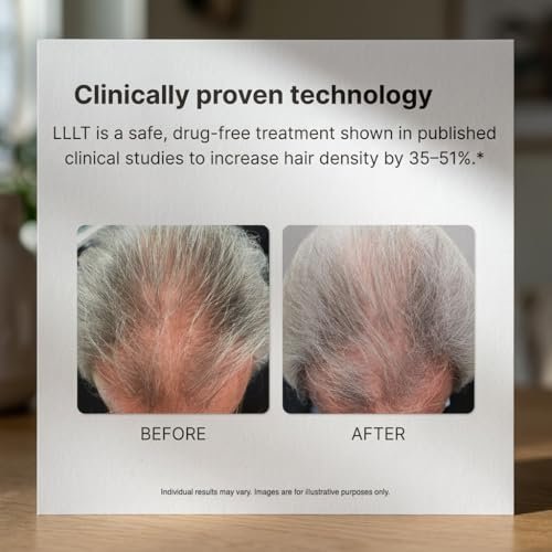 Xtrallux Alpha Hair Growth Laser Cap - FDA Cleared 136 Lasers for Men & Women, SMT Technology, 6-Min Daily Treatment - görsel 8