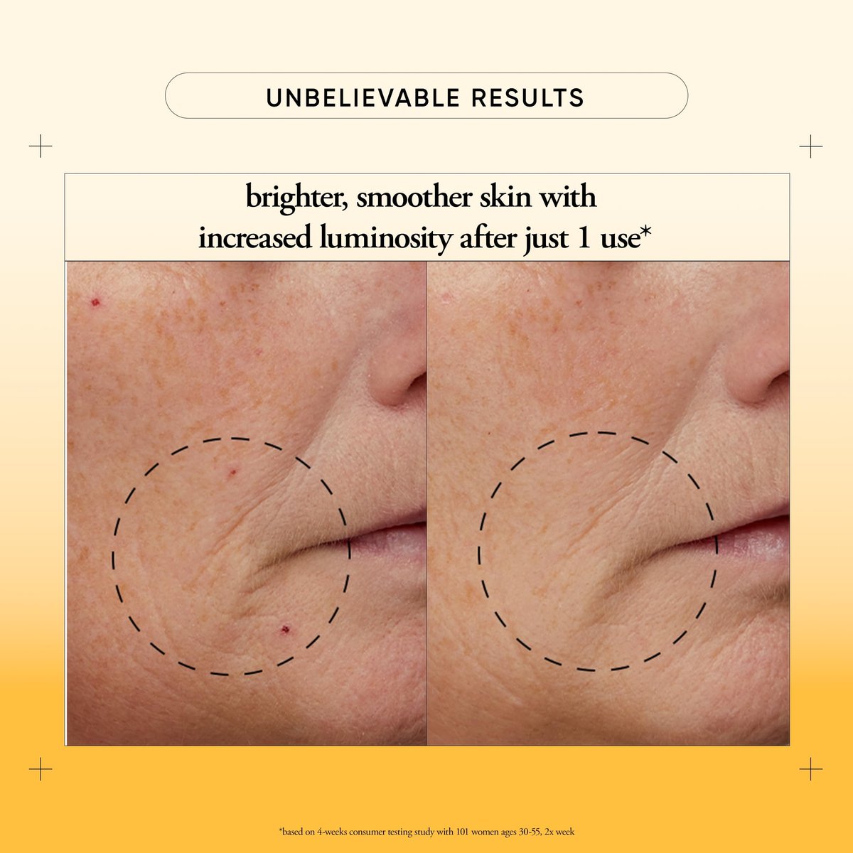 philosophy microdelivery vitamin c resurfacing peel kit - two-step facial peel with lactic acid & sunflower seed oil for smooth texture, even tone & fine lines Avelisse