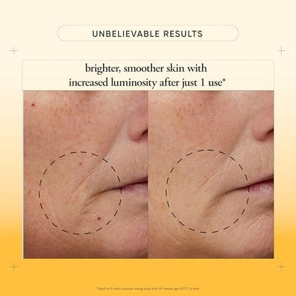 philosophy microdelivery vitamin c resurfacing peel kit - two-step facial peel with lactic acid & sunflower seed oil for smooth texture, even tone & fine lines Avelisse