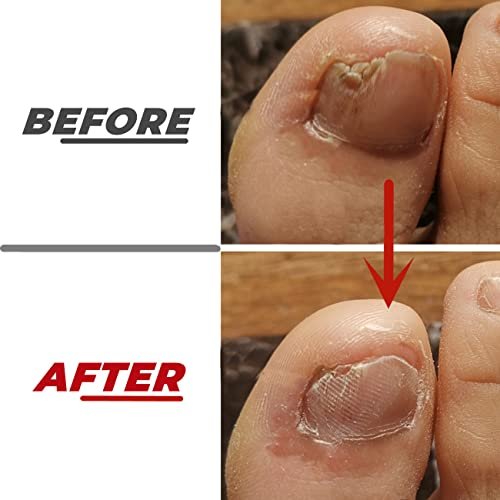 IDOU 2-Piece Stainless Steel Toe Nail Files for Thick Nails – 4 Sides, for Men, Seniors & Dogs - görsel 8