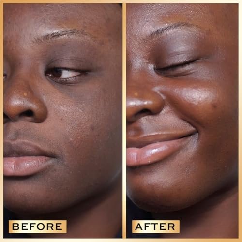 Revolution Pro Miracle Serum - Hydrating Face Serum with Hyaluronic Acid & Niacinamide for Dullness & Uneven Skin Tone, 1 oz - görsel 4
