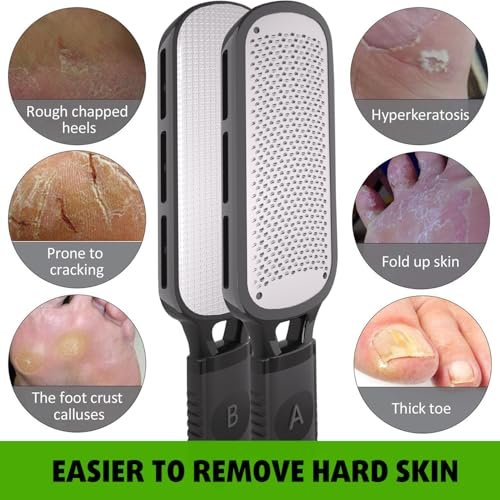 Antonki Double Sided Foot File for Dead Skin – Stainless Steel Callus Remover & Metal Foot Scraper for Cracked Heels, Professional Pedicure Tool (Black) - görsel 9