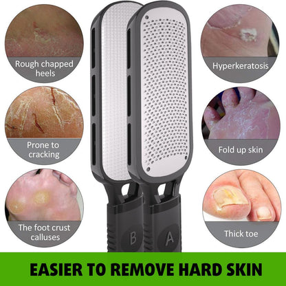 Antonki Double Sided Foot File for Dead Skin – Stainless Steel Callus Remover & Metal Foot Scraper for Cracked Heels, Professional Pedicure Tool (Black)