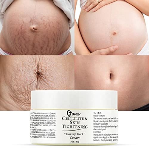 Stretch Marks & Scars Removal Cream for Pregnancy – Gentle Abdominal Firming & Scar Repair Skincare Avelisse
