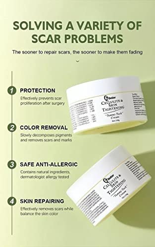 Stretch Marks & Scars Removal Cream for Pregnancy – Gentle Abdominal Firming & Scar Repair Skincare Avelisse