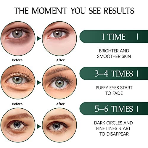 Tiepetly Under Eye Masks – Collagen Eye Mask with Green Tea, 60 Pcs for Puffy Eyes, Dark Circles & Hydration - görsel 6
