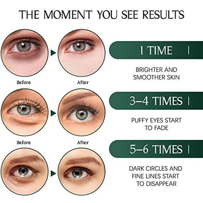 Tiepetly Under Eye Masks – Collagen Eye Mask with Green Tea, 60 Pcs for Puffy Eyes, Dark Circles & Hydration