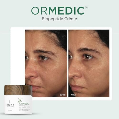 IMAGE Skincare ORMEDIC Biopeptide Crème - Balancing Face Moisturizer with Shea Butter, Hyaluronic Acid & Organic Plant Oils, 2 oz Avelisse
