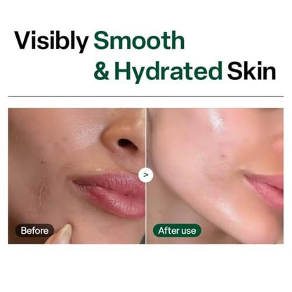 Dr. G Brightening Peeling Gel - Korean Exfoliator for Smooth, Glowy Skin - Hyaluronic Acid, Ceramides, Vitamin C - 4.23 fl oz