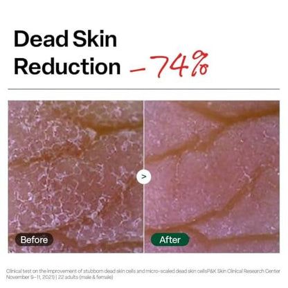 Dr. G Brightening Peeling Gel - Korean Exfoliator for Smooth, Glowy Skin - Hyaluronic Acid, Ceramides, Vitamin C - 4.23 fl oz