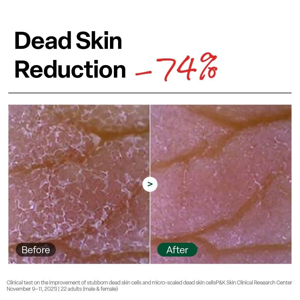 Dr. G Brightening Peeling Gel - Korean Exfoliator for Smooth, Glowy Skin - Hyaluronic Acid, Ceramides, Vitamin C - 4.23 fl oz - görsel 7