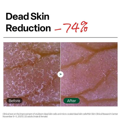 Dr. G Brightening Peeling Gel - Korean Exfoliator for Smooth, Glowy Skin - Hyaluronic Acid, Ceramides, Vitamin C - 4.23 fl oz