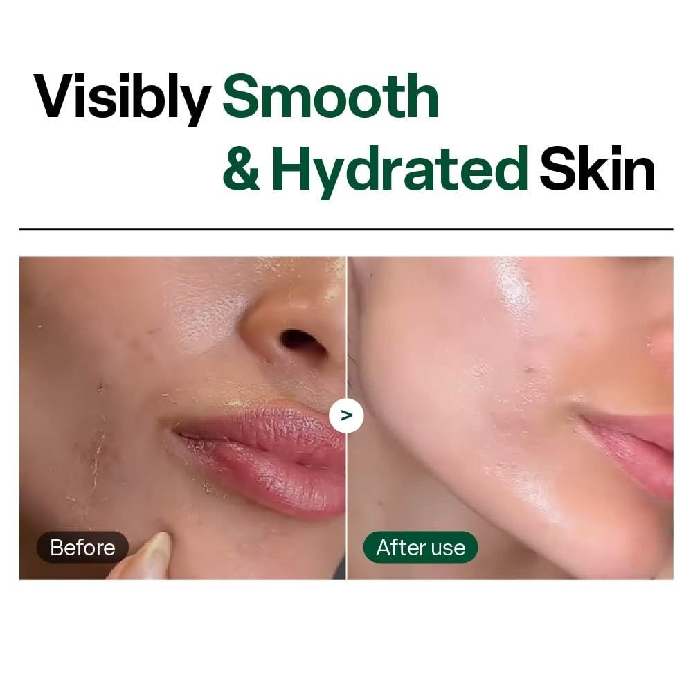 Dr. G Brightening Peeling Gel - Korean Exfoliator for Smooth, Glowy Skin - Hyaluronic Acid, Ceramides, Vitamin C - 4.23 fl oz - görsel 9
