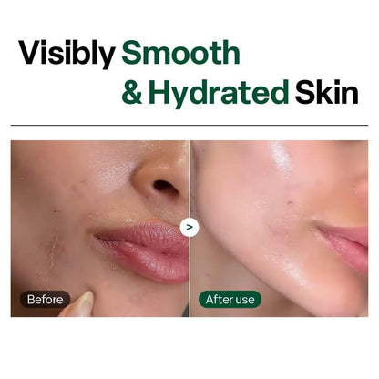 Dr. G Brightening Peeling Gel - Korean Exfoliator for Smooth, Glowy Skin - Hyaluronic Acid, Ceramides, Vitamin C - 4.23 fl oz