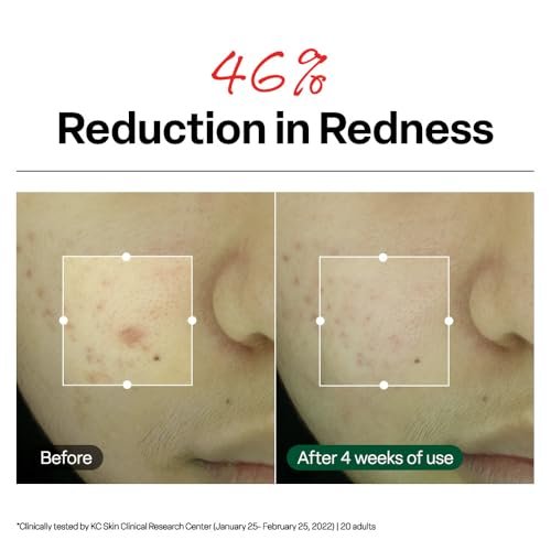 Dr. G R.E.D. Blemish Clear Soothing Cream - Calming Korean Moisturizer for Redness, Soothes Acne & Irritation, with Centella Asiatica, Long-Lasting Hydration, 2.36 fl oz Avelisse