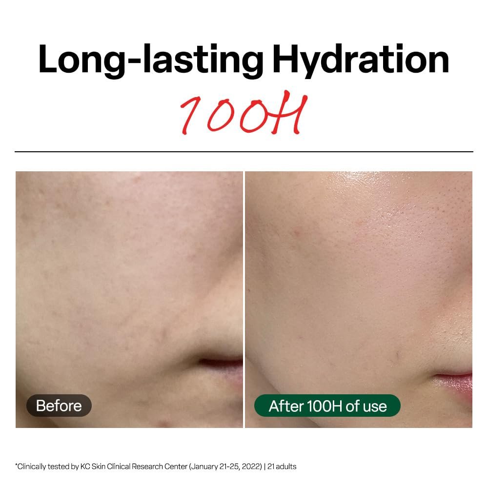 Dr. G R.E.D. Blemish Clear Soothing Cream - Calming Korean Moisturizer for Redness, Soothes Acne & Irritation, with Centella Asiatica, Long-Lasting Hydration, 2.36 fl oz Avelisse