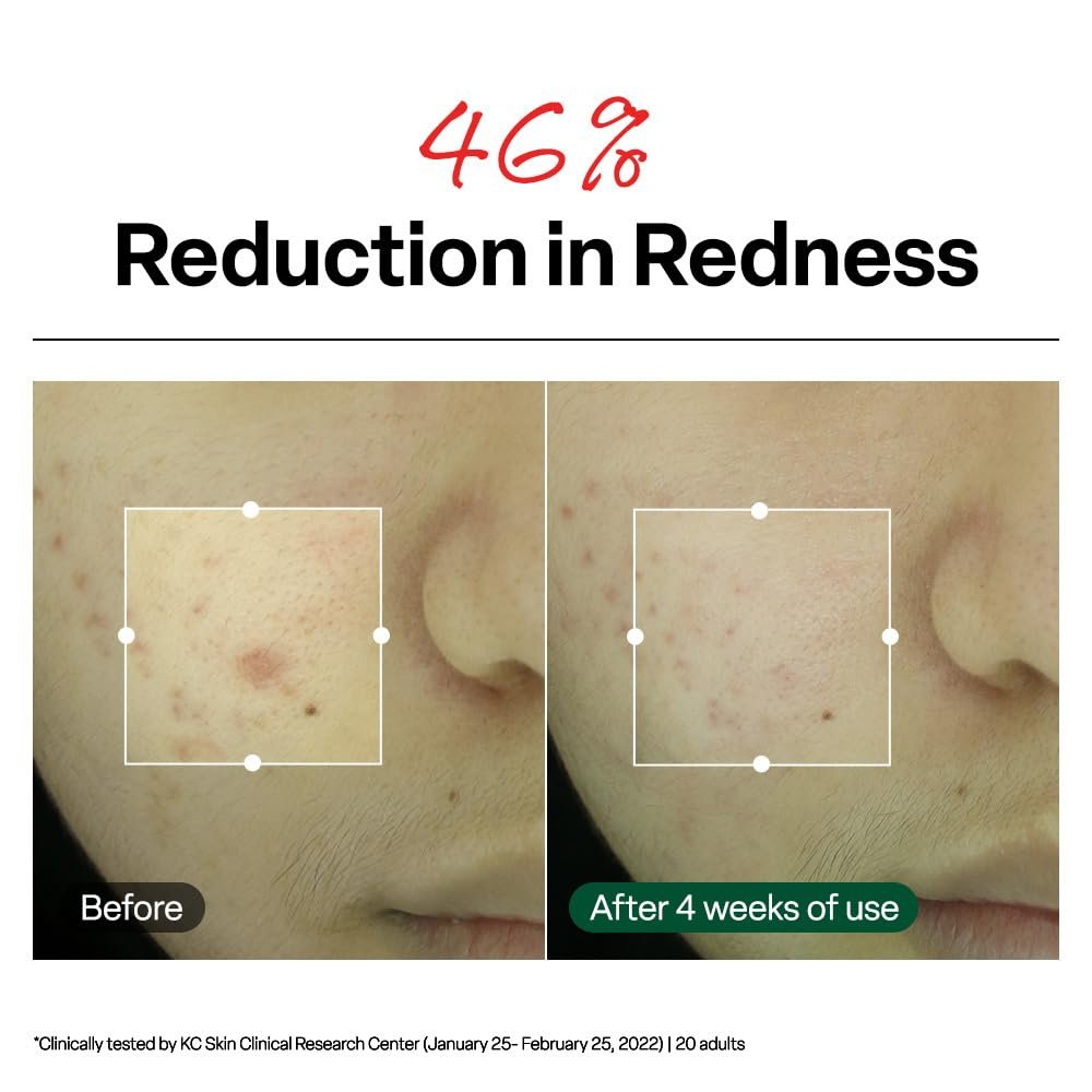 Dr. G R.E.D. Blemish Clear Soothing Cream - Calming Korean Moisturizer for Redness, Soothes Acne & Irritation, with Centella Asiatica, Long-Lasting Hydration, 2.36 fl oz Avelisse