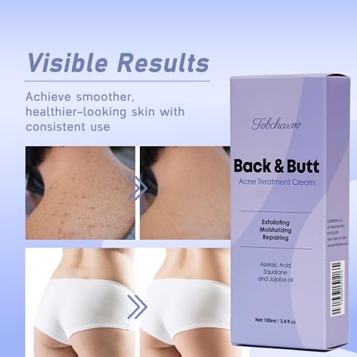 Maximum Strength Butt Acne Clearing Treatment - Body Cream for Back, Buttocks, Thigh & Chest Acne Removal - Skin Clearing Lotion for Men & Women - Foaming Cleanser for Bacne & Cystic Acne - görsel 3