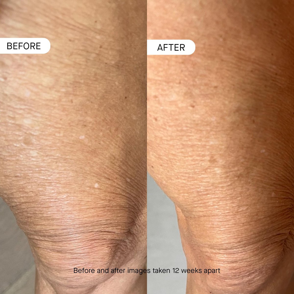 oneskin BODY OS-01 Peptide Topical Supplement & Skin Longevity Age Reversal Moisturizer - Fragrance-Free, Safe for Sensitive Skin, 8.45 oz Avelisse