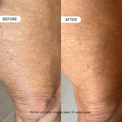 oneskin BODY OS-01 Peptide Topical Supplement & Skin Longevity Age Reversal Moisturizer - Fragrance-Free, Safe for Sensitive Skin, 8.45 oz Avelisse