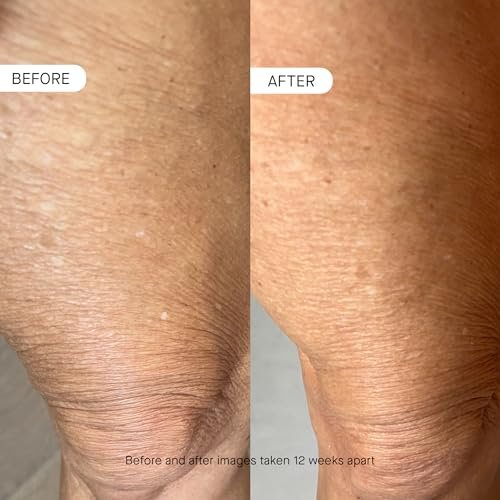 oneskin BODY OS-01 Peptide Topical Supplement & Skin Longevity Age Reversal Moisturizer - Fragrance-Free, Safe for Sensitive Skin, 8.45 oz Avelisse