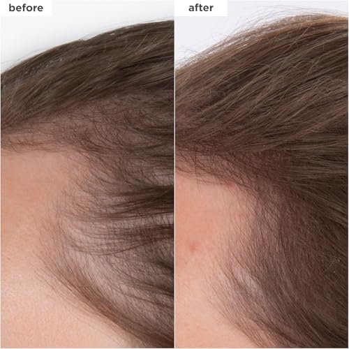Briogeo Destined for Density Caffeine + Biotin Peptide Density Serum – Increases Hair Thickness & Volume for Fine or Thinning Hair, Fast-Absorbing, Non-Greasy, Fragrance-Free, Vegan & Cruelty-Free Avelisse