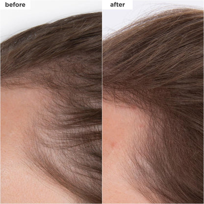 Briogeo Destined for Density Caffeine + Biotin Peptide Density Serum – Increases Hair Thickness & Volume for Fine or Thinning Hair, Fast-Absorbing, Non-Greasy, Fragrance-Free, Vegan & Cruelty-Free Avelisse
