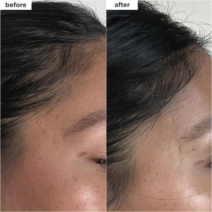 Briogeo Destined for Density Caffeine + Biotin Peptide Density Serum – Increases Hair Thickness & Volume for Fine or Thinning Hair, Fast-Absorbing, Non-Greasy, Fragrance-Free, Vegan & Cruelty-Free Avelisse
