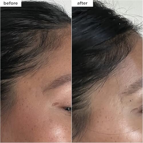 Briogeo Destined for Density Caffeine + Biotin Peptide Density Serum – Increases Hair Thickness & Volume for Fine or Thinning Hair, Fast-Absorbing, Non-Greasy, Fragrance-Free, Vegan & Cruelty-Free Avelisse