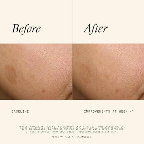SkinMedica Even & Correct Dark Spot Cream - 0.5 Fl Oz | Reduce Stubborn Dark Spots Avelisse